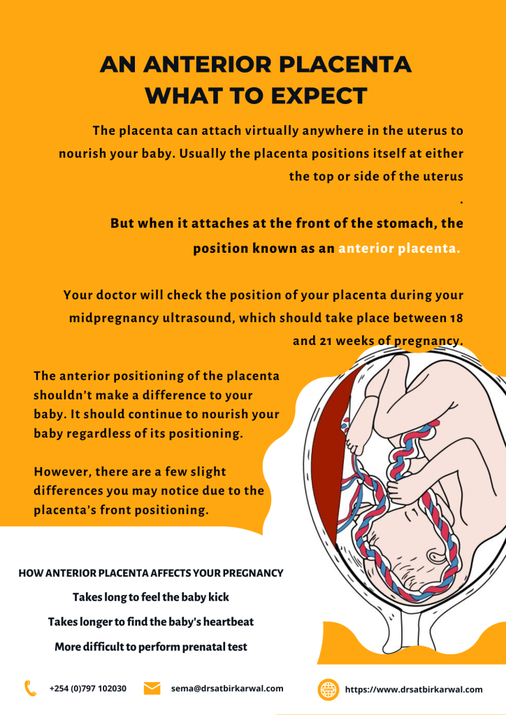 What is an anterior placenta?