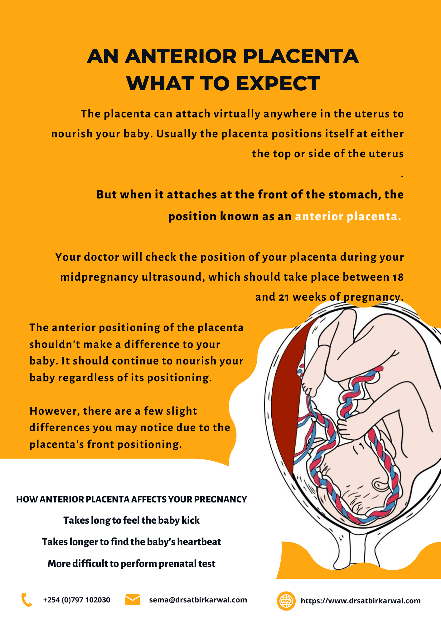 Anterior Placenta What To Expect Dr Satbir Karwal